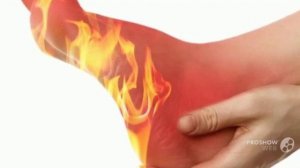 О чем говорят горящие подошвы стоп горит огнем голова причины