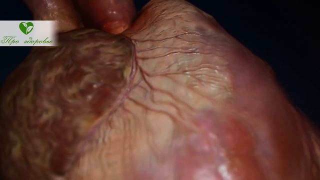 Запомни! Золотые продукты для сердца, сосудов и чистой крови! смотреть онлайн