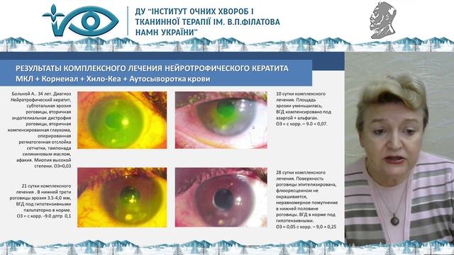 Сателіт Сона-Фармексім смотреть онлайн
