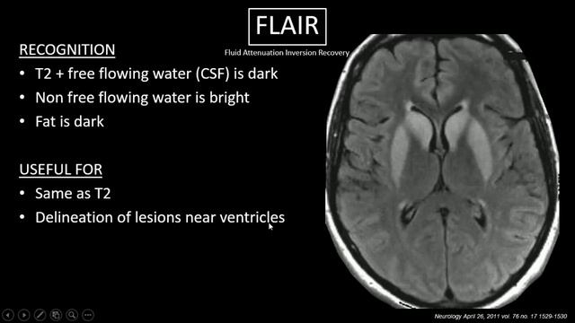 MRI,T2,T1,Flair ,DWI смотреть онлайн