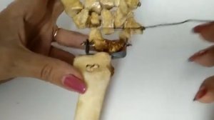 КОСТИ КИСТИ (ЗАПЯСТЬЕ: ПРОКСИМАЛЬНЫЙ И ДИСТАЛЬНЫЙ РЯДЫ, ПЯСТНЫЕ КОСТИ, ФАЛАНГИ ПАЛЬЦЕВ)