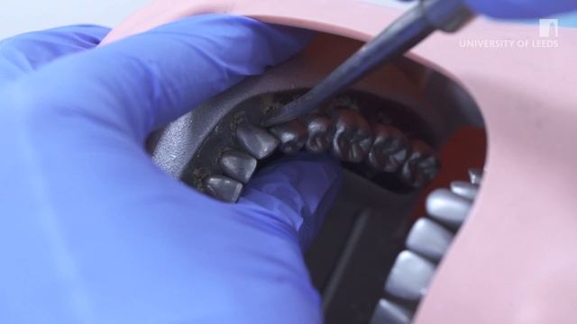 Demonstration of Luxator Technique for Dental Extraction смотреть онлайн
