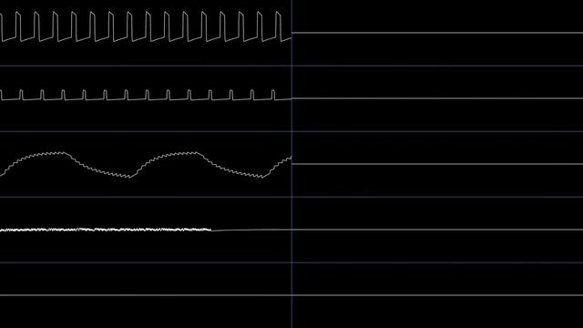 commandycan - Tidesplitter.NSF (Oscilloscope View) смотреть онлайн