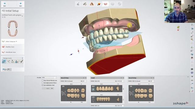 3shape dentures with nextdent 5100 printer смотреть онлайн