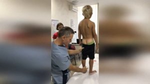 Сколиоз у детей. Методы определения сколиоза в домашних условиях