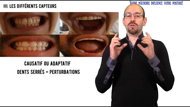 SSCS Training e-learning - www.sscstraining.org - Extrait "Posturologie & Sport" - les capteurs смотреть онлайн