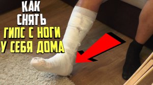 Как снять гипс с ноги в домашних условиях
