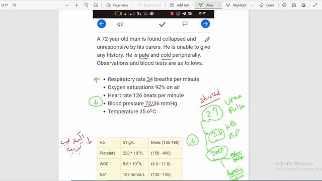 (GIT) (6) pass medicine 2023 ..... upper GI bleeding смотреть онлайн