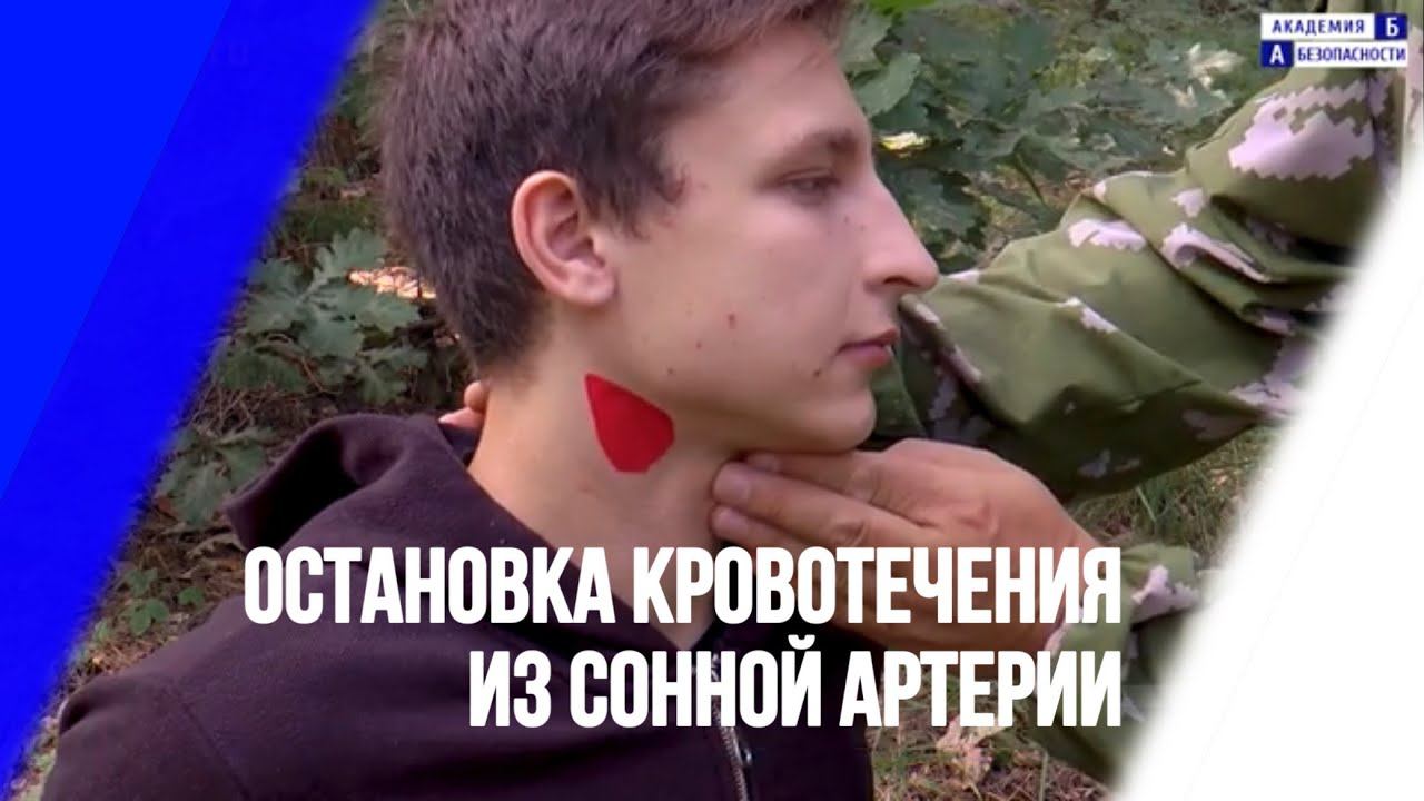 Остановка кровотечения из сонной артерии прижатием. Способ №1 смотреть онлайн