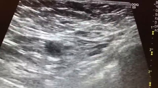 Посвящение в тайный круг