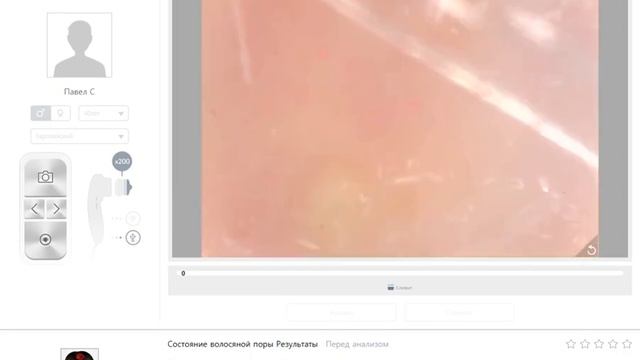 ASW диагностика волос и кожи головы