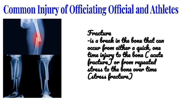P.E Grade-9 Quarter-1 ( Common Injuries of Officiating Officials and Athletes) смотреть онлайн