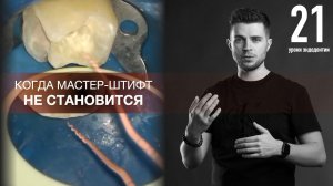 Уроки эндодонтии. Когда не становится мастер-штифт