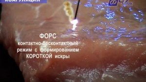 Видеоруководство по применению аппарата «ФОТЕК Е81М»