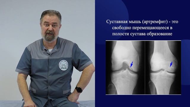 Травма, разрыв мениска. Оперировать или лечить? смотреть онлайн