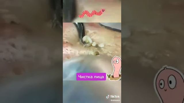 satisfying video, черные точки выдавливание черных точек, удовольствием, кайф для глаз😍 смотреть онлайн