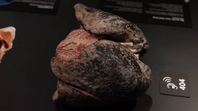 episode 2: body world [amsterdam] смотреть онлайн