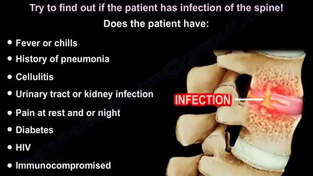 When does low back pain become a cause for concern? Learn about red flags when you see the doctor. смотреть онлайн