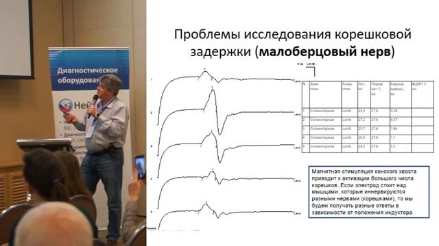 С.Г. Николаев, Диагностика радикулопатий смотреть онлайн