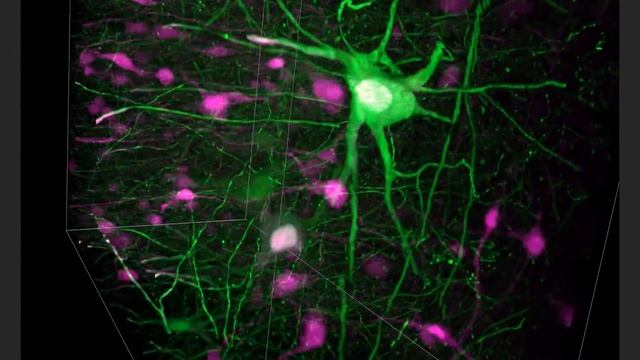 Expanded mouse spinal cord imaged using SCAPE 2.0 in 100 seconds смотреть онлайн