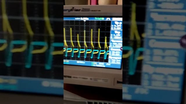 18 03 17 качер бифом смотреть онлайн