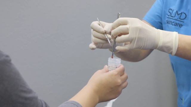 Dr. Lee Treats Sisters With Matching Bumps! I Dr. Pimple Popper смотреть онлайн