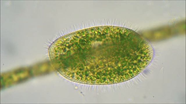 Инфузория Бурсария (Ciliate Paramecium bursaria) смотреть онлайн