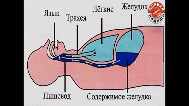 17.02.2019 МСК 14-00 Первая помощь при ДТП.. смотреть онлайн