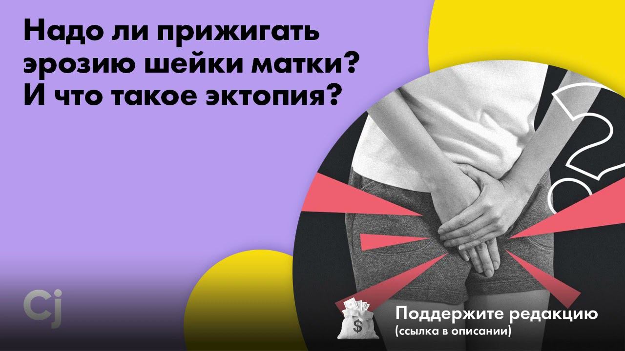 Надо ли прижигать эрозию шейки матки? И что такое эктопия? смотреть онлайн