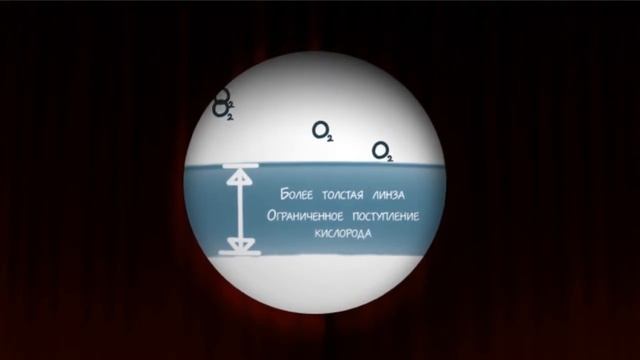 Материал контактных линз смотреть онлайн