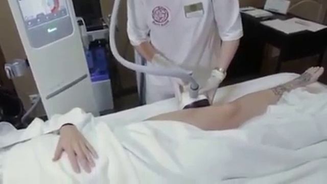 Корректируем фигуру с VelaShape III смотреть онлайн