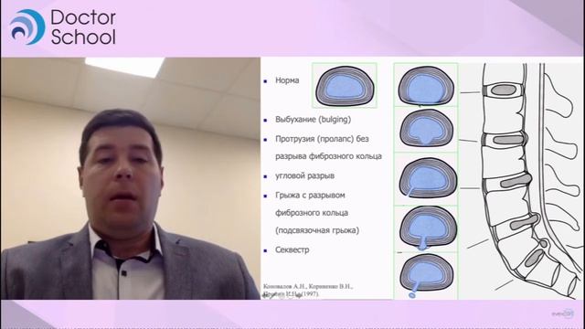 МРТ позвоночника Грыжи межпозвонковых дисков, протрузии, экструзии, секвестрация смотреть онлайн
