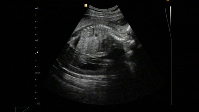 Наш Артёмка