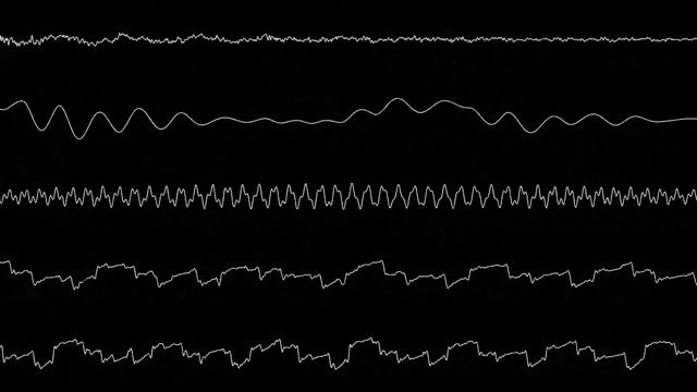 Kirby's Dream Land 3 - Zero (oscilloscope) смотреть онлайн