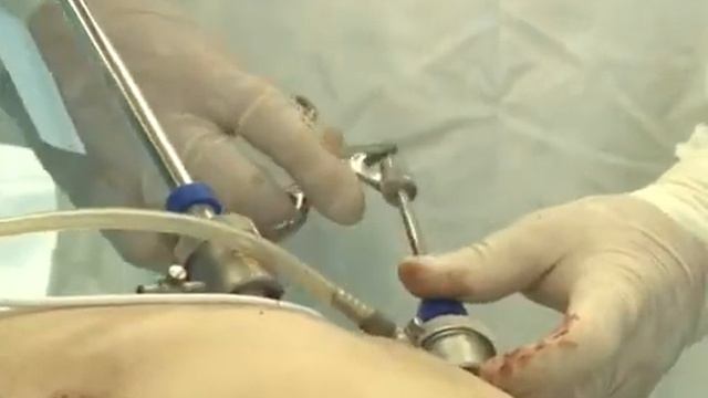 УНИКАЛЬНАЯ ОПЕРАЦИЯ смотреть онлайн