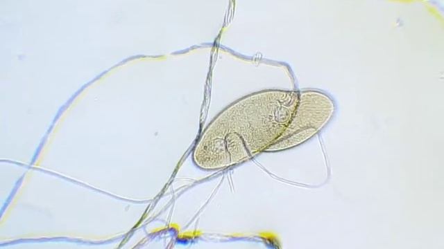 инфузория запуталась в вате смотреть онлайн