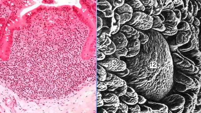 Пищеварительная система - 3. Видео лекция С.М.Зиматкин (21) смотреть онлайн