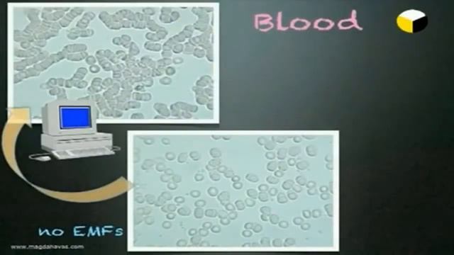 ШОК! Влияние электромагнитного излучения на кровь человека смотреть онлайн