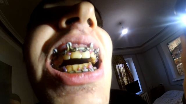 VLOG: СНИМАЮ ЖЕЛЕЗКИ! РАНЬШЕ ВРЕМЕНИ! смотреть онлайн