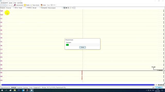 12  Углубленное ЭЭГ обследование