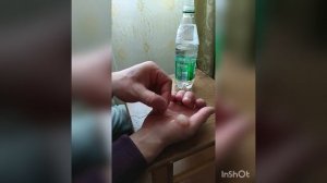 Ожог 2степени, ожоговые пузыри, чтоделать