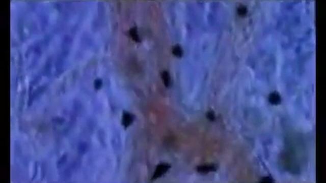 Клетка нашего организма. Очистка и защита!!! смотреть онлайн