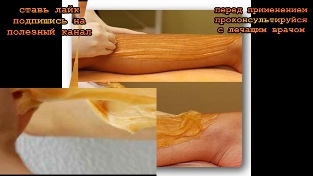 ★Как приготовить пасту для сахарной эпиляции. Шугаринг удалит волоски с корнем смотреть онлайн