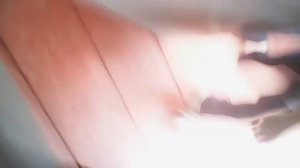 Жесть смайл дог укусил за ногу жесть