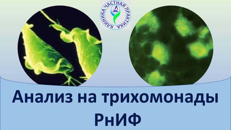 Анализ на трихомониаз РнИФ смотреть онлайн