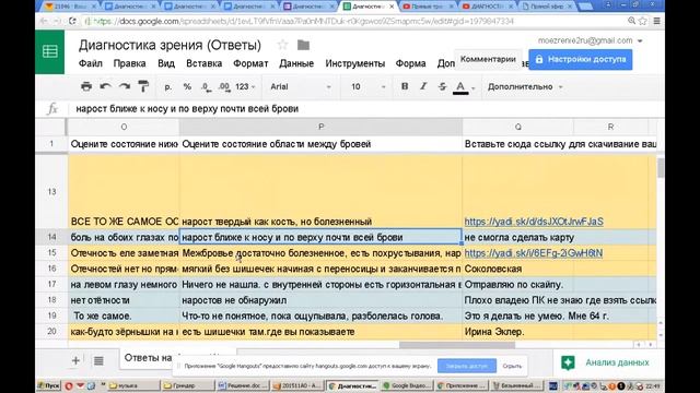 Диагностика зрения миопии высокой степени от -7 и дальнозоркости. смотреть онлайн