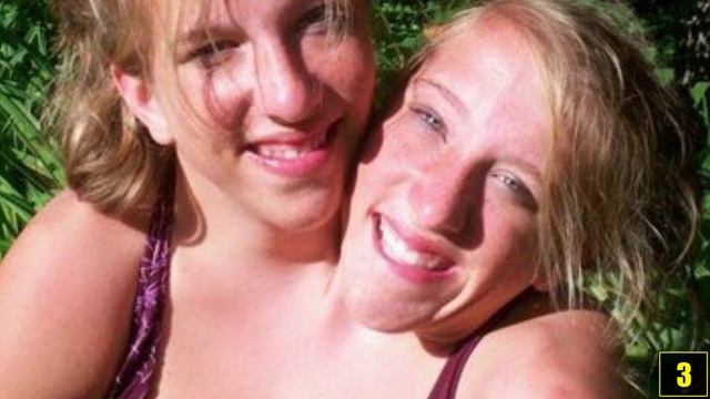 5 ЛЮДЕЙ С ЛИШНИМИ ЧАСТЯМИ ТЕЛА ! смотреть онлайн
