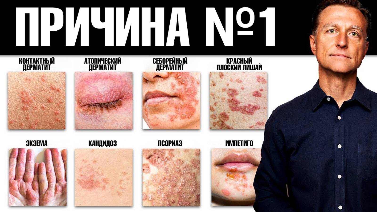 При ВСЕХ кожных заболеваниях есть дефицит этого...😲 смотреть онлайн