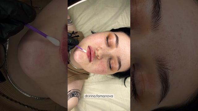 Увеличение губ Уфа. Обучение по технике «Плоский бант». @dr.irina.famanova