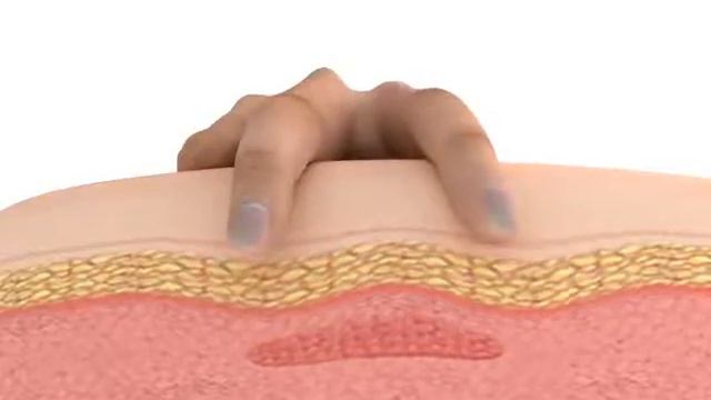 Trigger Point Detection смотреть онлайн